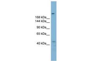 Image no. 1 for anti-Retinoblastoma Binding Protein 6 (RBBP6) (AA 395-444) antibody (ABIN6743153)