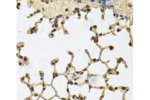 Immunohistochemistry of paraffin-embedded Mouse lung using IFI16 Polyclonal Antibody at dilution of 1:100 (40x lens). (IFI16 Antikörper)