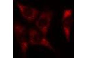 ABIN6278584 staining Hela cells by IF/ICC. (JTB Antikörper  (Internal Region))