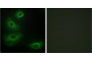 Immunofluorescence analysis of HeLa cells, using 5-HT-1B Antibody. (5HT1B Receptor Antikörper  (AA 201-250))
