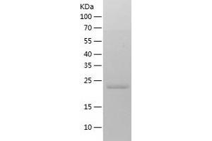 Western Blotting (WB) image for RAB11A, Member RAS Oncogene Family (RAB11A) (AA 1-213) protein (His tag) (ABIN7124734) (RAB11A Protein (AA 1-213) (His tag))