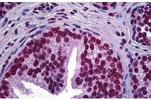 Human Prostate: Formalin-Fixed, Paraffin-Embedded (FFPE) (LHX4 Antikörper  (AA 291-390))
