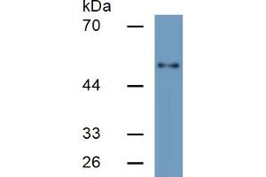 Rabbit Detection antibody from the kit in WB with Positive Control: Sample Human HepG2 cell lysate;.