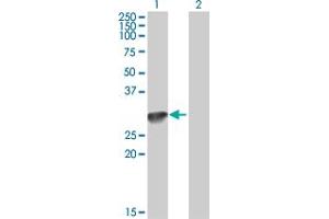 Western Blot analysis of C1QA expression in transfected 293T cell line by C1QA MaxPab polyclonal antibody. (C1QA Antikörper  (AA 23-245))