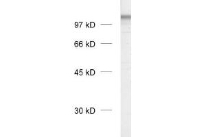 dilution: 1 : 1000, sample: crude synaptosomal fraction of rat brain (P2) (Neuroligin 1 Antikörper  (Extracellular Domain))