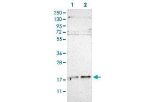 Western Blot (Cell lysate) analysis of (1) Human RT-4 cell and (2) Human U-251MG sp cell. (UBE2G2 Antikörper)