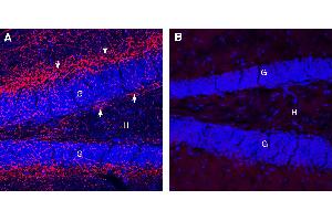 Expression of Cannabinoid Receptor 1 in mouse hippocampus.