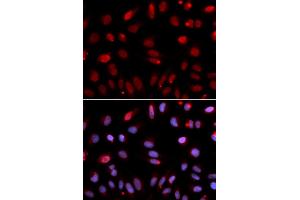 Immunofluorescence analysis of U2OS cells using HUS1 antibody (ABIN5973136). (HUS1 Antikörper)