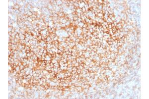 Formalin-fixed, paraffin-embedded human Tonsil stained with CD73 Mouse Monoclonal Antibody (NT5E/2545). (CD73 Antikörper)