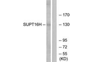Western blot analysis of extracts from HepG2/Jurkat cells, using SUPT16H Antibody.