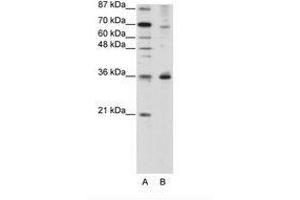 Image no. 1 for anti-Forkhead Box Q1 (FOXQ1) (N-Term) antibody (ABIN202434) (FOXQ1 Antikörper  (N-Term))