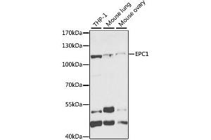 Western blot analysis of extracts of various cell lines, using EPC1 antibody (ABIN2562436) at 1:1000 dilution. (EPC1 Antikörper)