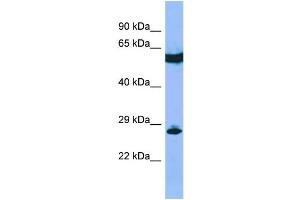Host: Rabbit Target Name: C22orf13 Sample Type: RPMI-8226 Whole Cell lysates Antibody Dilution: 1. (C22orf13 Antikörper  (Middle Region))