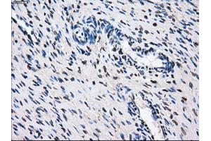 Immunohistochemical staining of paraffin-embedded Ovary tissue using anti-GBE1 mouse monoclonal antibody. (GBE1 Antikörper)