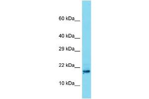 Host: Rabbit Target Name: C8orf42 Sample Type: Placenta lysates Antibody Dilution: 1. (TDRP/C8orf42 Antikörper  (N-Term))