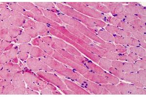 Human Skeletal Muscle: Formalin-Fixed, Paraffin-Embedded (FFPE)