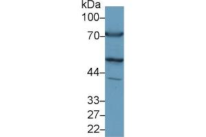 Western Blot; Sample: Rat Heart lysate; Primary Ab: 1µg/ml Rabbit Anti-Rat ALT Antibody Second Ab: 0. (ALT Antikörper  (AA 203-443))