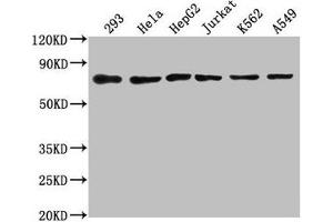 Western Blot Positive WB detected in: 293 whole cell lysate, Hela whole cell lysate, HepG2 whole cell lysate, Jurkat whole cell lysate, K562 whole cell lysate, A549 whole cell lysate All lanes: HSPA8 antibody at 1:2000 Secondary Goat polyclonal to rabbit IgG at 1/50000 dilution Predicted band size: 71, 54 kDa Observed band size: 71 kDa (Hsc70 Antikörper  (AA 418-597))
