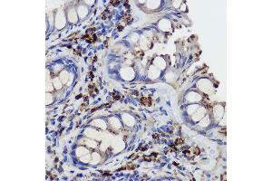 Immunohistochemistry (IHC) image for anti-Galactosidase, beta 1 (GLB1) (AA 1-270) antibody (ABIN3015643)
