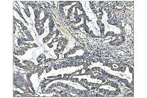 IHC analysis of ANGPT2 using anti-ANGPT2 antibody (ABIN7601450).