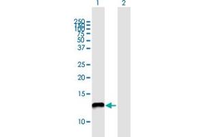 Western Blotting (WB) image for anti-NADH Dehydrogenase (Ubiquinone) 1 alpha Subcomplex, 5, 13kDa (NDUFA5) (AA 1-116) antibody (ABIN518227)
