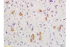 Formalin-fixed and paraffin embedded rat brain tissue labeled with Anti-APC/Adenomatous Polyposis Coli Polyclonal Antibody, Unconjugated  at 1:200 followed by conjugation to the secondary antibody, (SP-0023), and DAB staining (APC Antikörper  (AA 2751-2843))