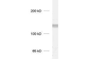 dilution: 1 : 1000, sample: crude synaptosomal fraction of rat brain (P2) (GRIK3 Antikörper  (C-Term))
