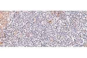 Immunohistochemistry of paraffin-embedded Human tonsil tissue using ITSN2 Polyclonal Antibody at dilution of 1:40(x200) (Intersectin 2 Antikörper)