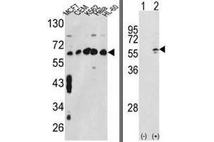 Image no. 1 for anti-Chaperonin Containing TCP1, Subunit 3 (Gamma) (CCT3) (Middle Region) antibody (ABIN452829) (CCT3 Antikörper  (Middle Region))