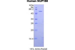 SDS-PAGE analysis of Human Nucleoporin 188 kDa Protein. (NUP188 Protein)