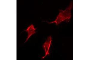 ABIN6277355 staining HepG2 by IF/ICC. (Dopamine Receptor d1 Antikörper  (N-Term))
