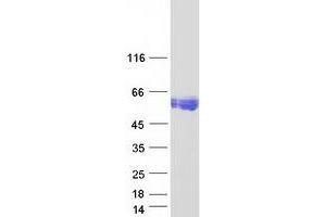 CEACAM16 Protein (Myc-DYKDDDDK Tag)