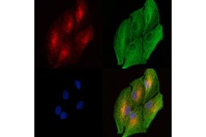 ABIN6261215 and ABIN6277963 staining  cells by IF/ICC.
