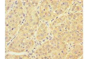 Immunohistochemistry (IHC) image for anti-Pterin-4 alpha-Carbinolamine Dehydratase/dimerization Cofactor of Hepatocyte Nuclear Factor 1 alpha (PCBD1) (AA 2-104) antibody (ABIN7166614)
