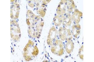 Immunohistochemistry of paraffin-embedded Human stomach using MRPL11 Polyclonal Antibody at dilution of 1:100 (40x lens). (MRPL11 Antikörper)