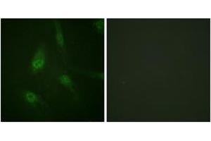Immunofluorescence analysis of HeLa cells, using NFAT4 (Phospho-Ser165) Antibody. (NFATC3 Antikörper  (pSer165))
