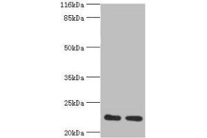 Western blot All lanes: RERG antibody at 2 μg/mL Lane 1: Mouse thymus tissue Lane 2: Rat lung tissue Secondary Goat polyclonal to rabbit at 1/10000 dilution Predicted band size: 23, 21 kDa Observed band size: 23 kDa