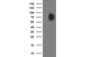 Western Blotting (WB) image for anti-Interferon Regulatory Factor 6 (IRF6) antibody (ABIN1498903) (IRF6 Antikörper)