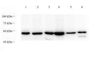 Western blot analysis of p38IP (ABIN7075954) at dilution of 1: 1000,Lane 1: Mouse testis tissue lysate,Lane 2: Mouse thymus tissue lysate,Lane 3: Mouse lung tissue lysate,Lane 4: Rat testis tissue lysate,Lane 5: Rat thymus tissue lysate,Lane 6: Rat lung tissue lysate (Transcription Factor SPT20 Homolog (SUPT20H) Antikörper)