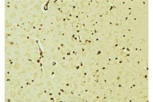 Immunohistochemistry (IHC) image for anti-Neuronal Differentiation 1 (NEUROD1) (N-Term) antibody (ABIN6263609)