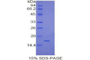 SDS-PAGE (SDS) image for Myosin, Light Chain 1, Alkali, Skeletal, Fast (MYL1) (AA 3-142) protein (His tag) (ABIN2121698)