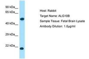 ALG10B Antikörper  (AA 104-153)