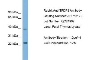WB Suggested Anti-TFDP3  Antibody Titration: 0. (TFDP3 Antikörper  (N-Term))