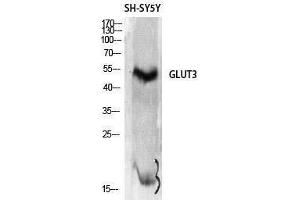 Western Blotting (WB) image for anti-Solute Carrier Family 2 (Facilitated Glucose Transporter), Member 3 (SLC2A3) (C-Term) antibody (ABIN3184811)