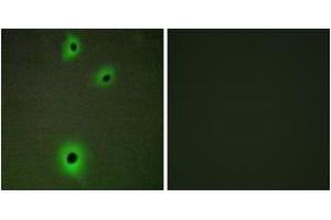 Immunofluorescence analysis of A549 cells, using CADM4 Antibody. (Cell Adhesion Molecule 4 Antikörper  (AA 339-388))