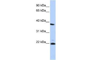 Western Blotting (WB) image for anti-Proteasome (Prosome, Macropain) Subunit, beta Type 2 (PSMB2) antibody (ABIN2459969) (PSMB2 Antikörper)