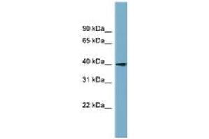 Image no. 1 for anti-Solute Carrier Family 25 (Mitochondrial Carrier: Glutamate), Member 22 (SLC25A22) (AA 71-120) antibody (ABIN6743230) (SLC25A22 Antikörper  (AA 71-120))