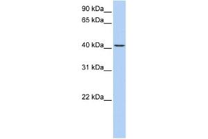 WB Suggested Anti-TMEM144 Antibody Titration:  0. (TMEM144 Antikörper  (Middle Region))