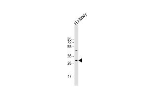Anti-NRIP2 Antibody (Center) at 1:1000 dilution + human kidney lysate Lysates/proteins at 20 μg per lane. (NRIP2 Antikörper  (AA 91-119))