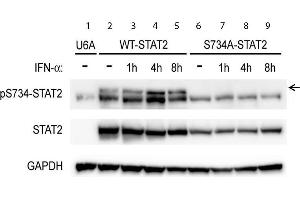 Western Blotting (WB) image for anti-Signal Transducer and Activator of Transcription 2, 113kDa (STAT2) (pSer734) antibody (ABIN5596752)